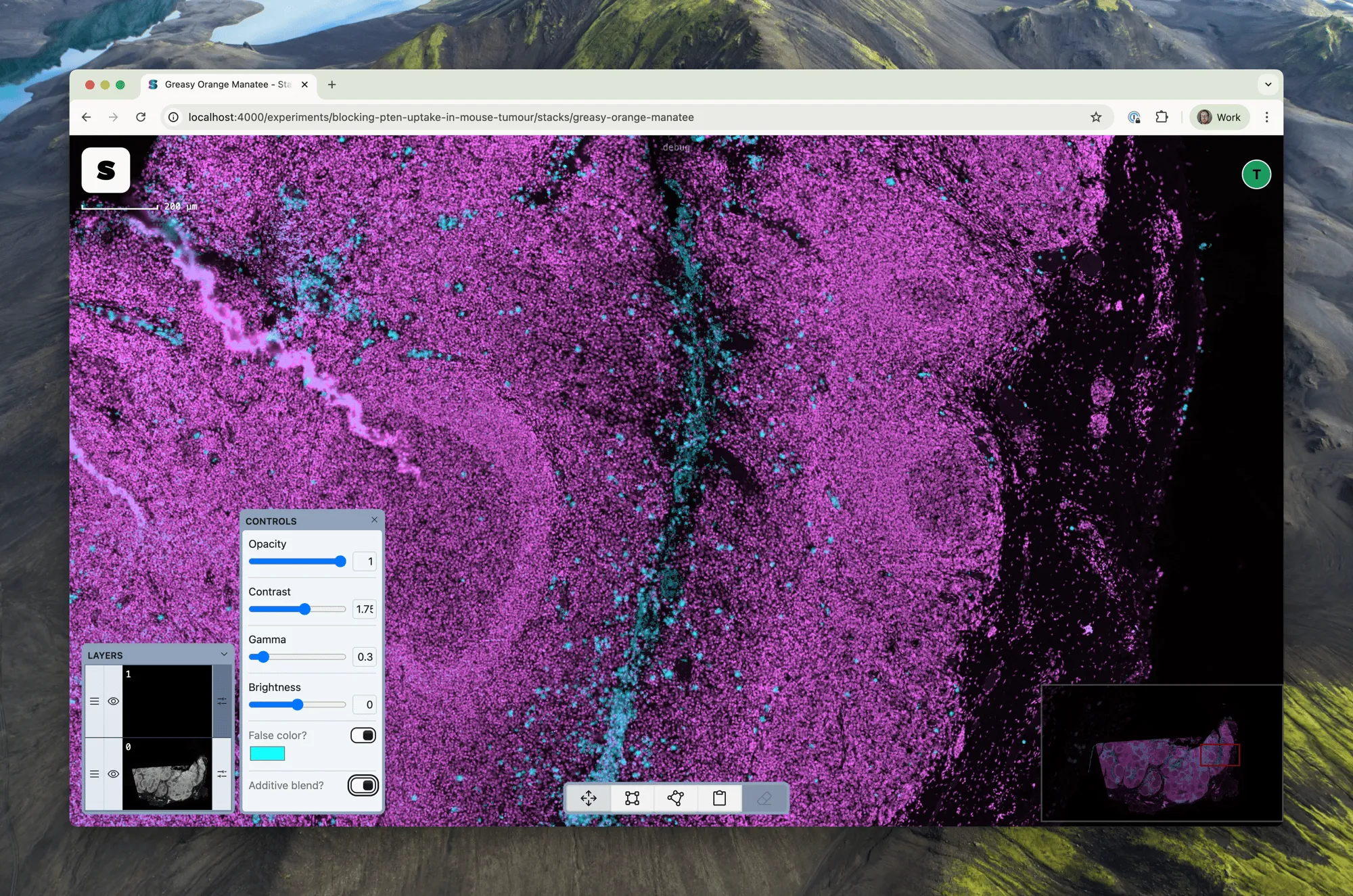 Both DAPI and CD15 layers with false colour applied